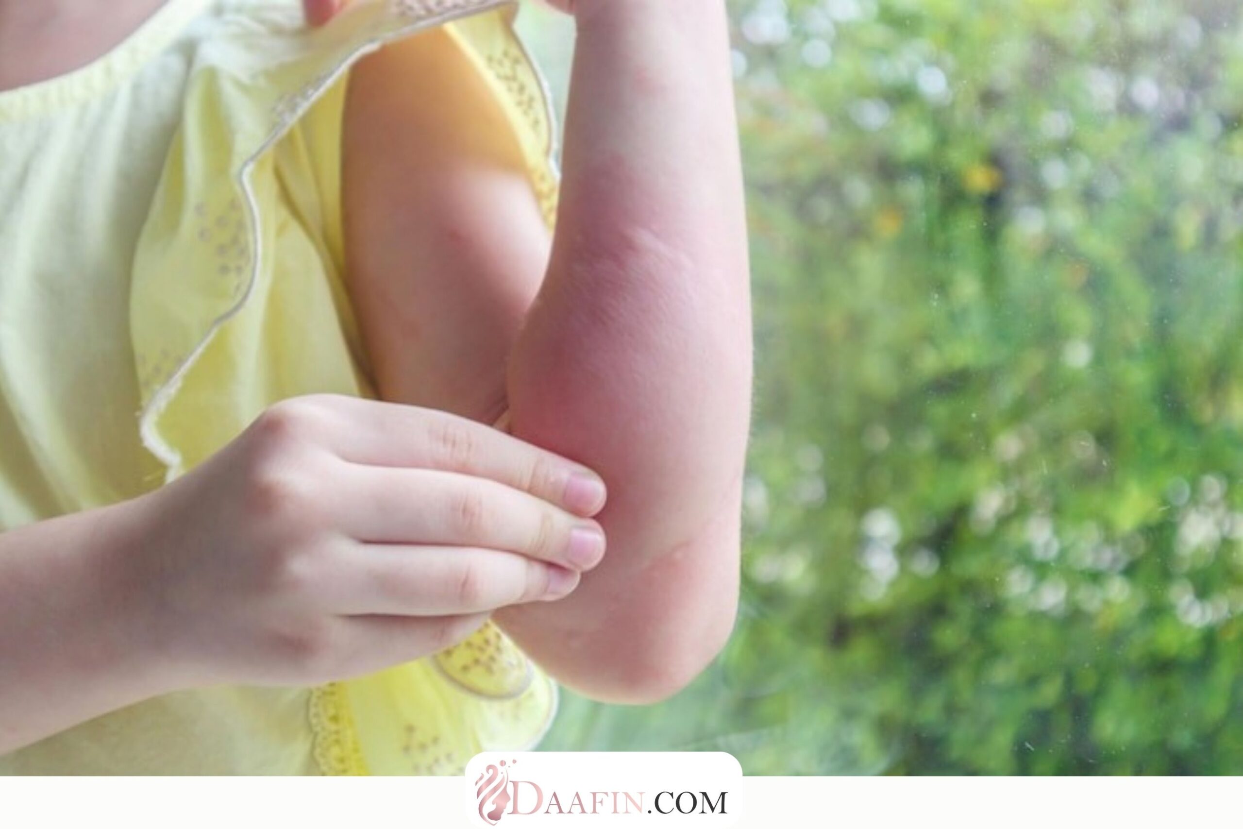 چگونه از حساسیتهای پوستی جلوگیری کنیم؟