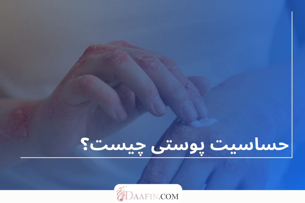 حساسیت پوستی چیست؟