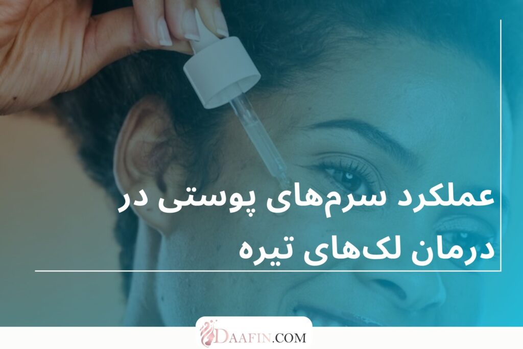 عملکرد سرمهای پوستی در درمان لکهای تیره