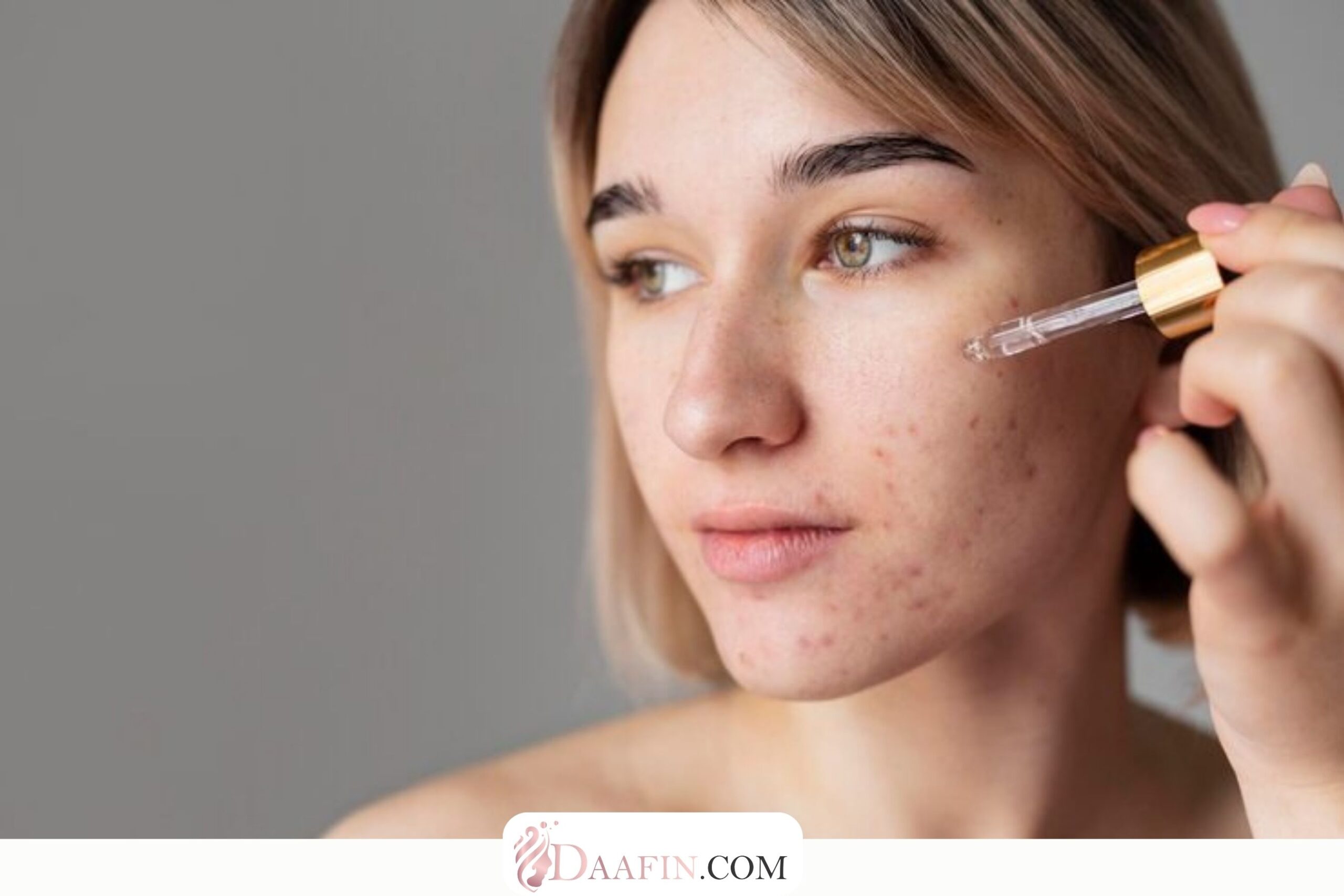 تأثیر سرم‌های حاوی سالیسیلیک اسید در درمان جوش