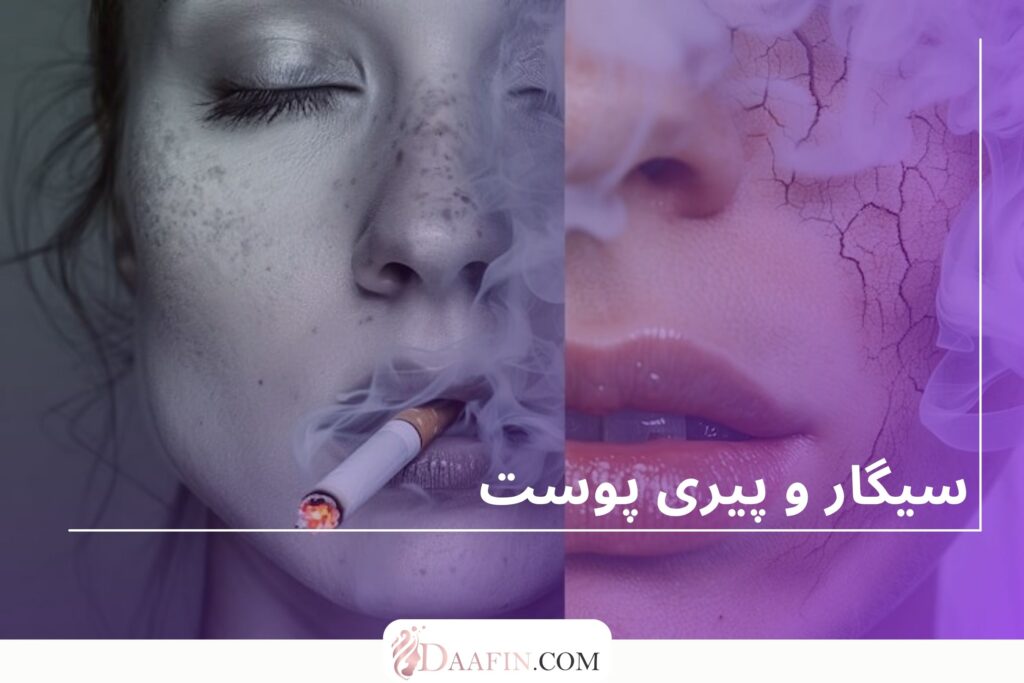 سیگار و پیری پوست