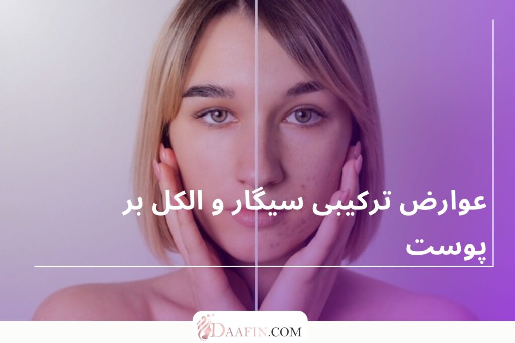 عوارض ترکیبی سیگار و الکل بر پوست