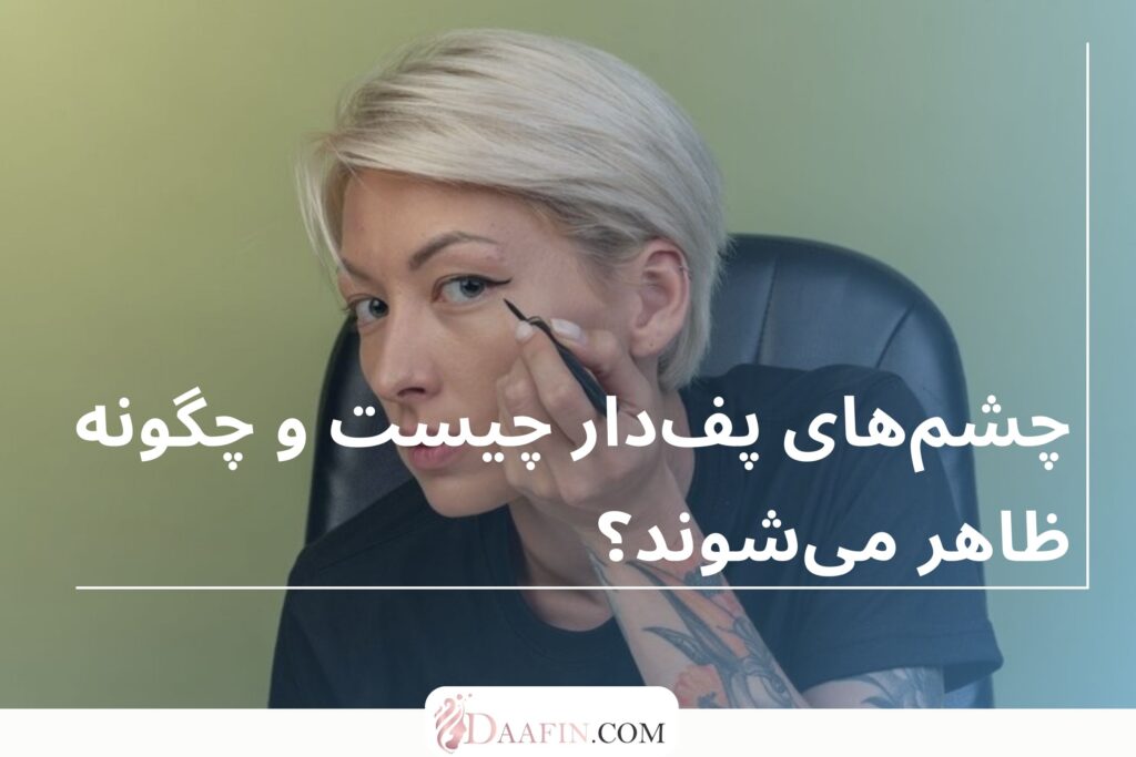 چشمهای پفدار چیست و چگونه ظاهر میشوند؟