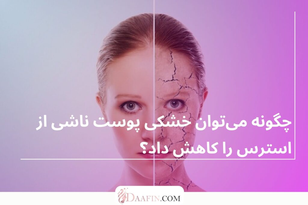 چگونه میتوان خشکی پوست ناشی از استرس را کاهش داد؟