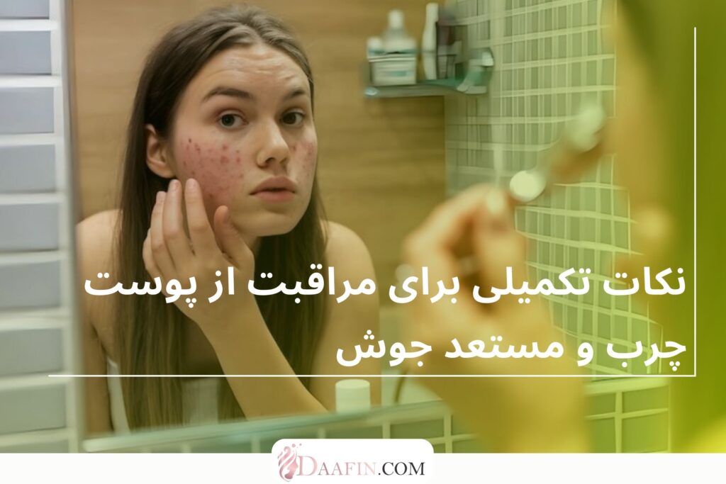 نکات تکمیلی برای مراقبت از پوست چرب و مستعد جوش