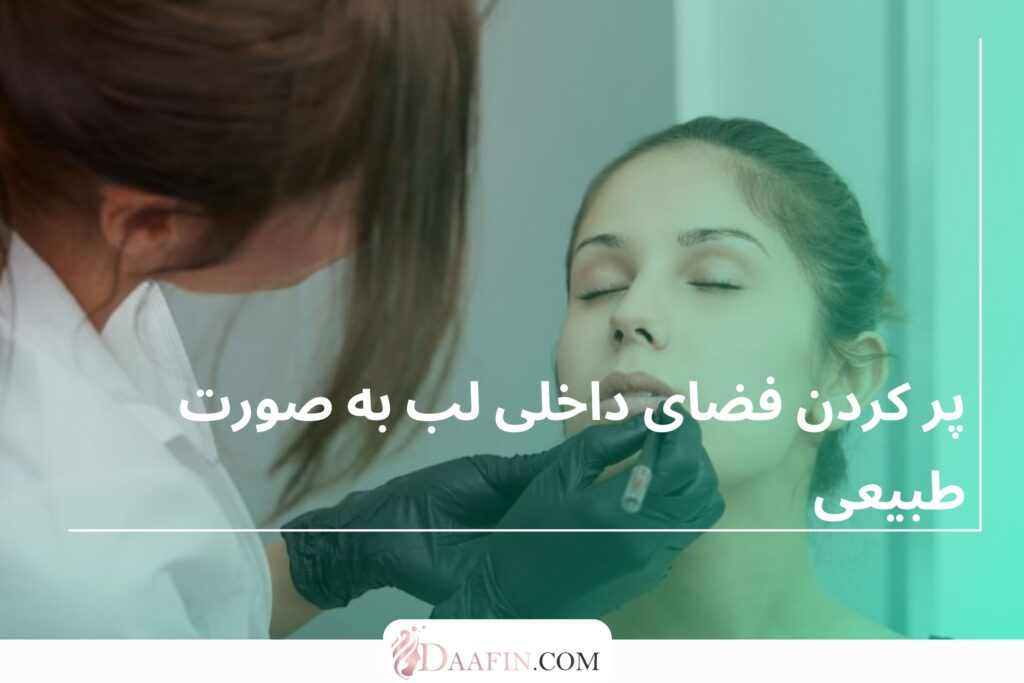 پر کردن فضای داخلی لب به صورت طبیعی