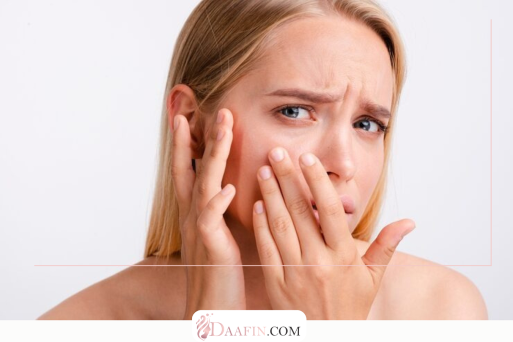 تحریک و التهاب پوست