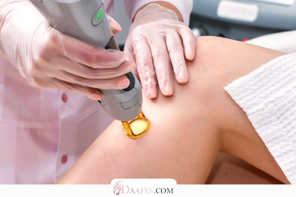 راهنمای جامع مراقبتهای بعد از لیزر موهای زائد: ۱۵ نکته حیاتی